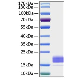 SDS-PAGE - Recombinant Human TIGIT Protein (C-terminal His Tag) (A331329) - Antibodies.com