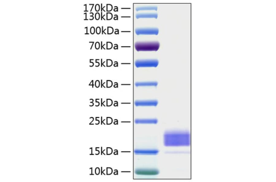 SDS-PAGE - Recombinant Human TIGIT Protein (C-terminal His Tag) (A331329) - Antibodies.com