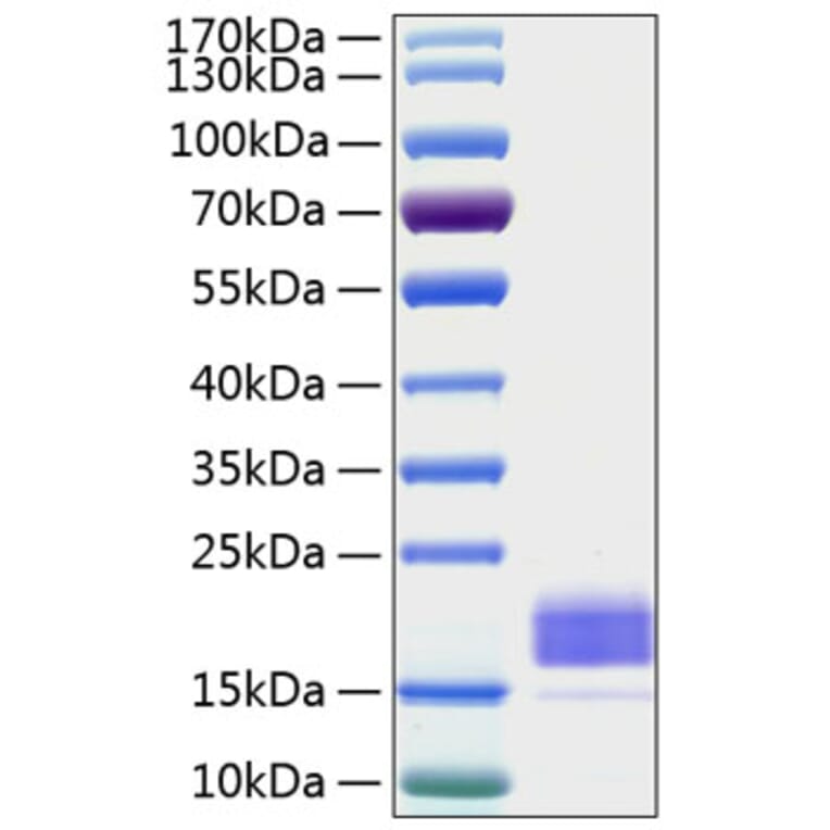 SDS-PAGE - Recombinant Human TIGIT Protein (C-terminal His Tag) (A331329) - Antibodies.com