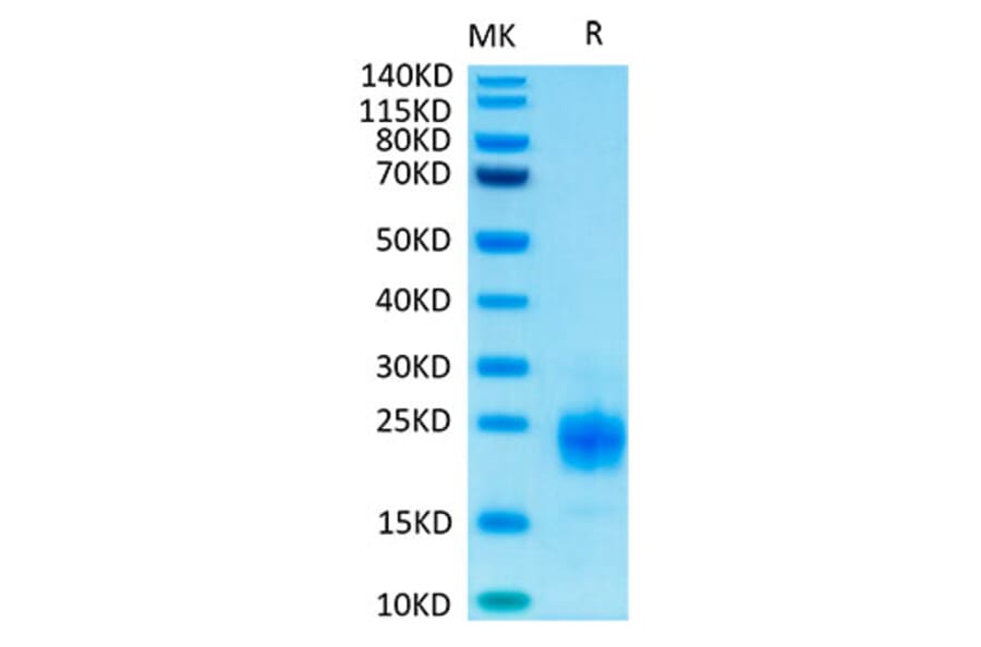 Tris-Bis PAGE - Recombinant Human TIGIT Protein (Biotin) (C-terminal His and Avi Tag) (A331330) - Antibodies.com