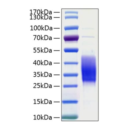 SDS-PAGE - Recombinant Human TIM 3 Protein (C-terminal His Tag) (A331331) - Antibodies.com