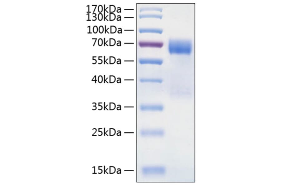 SDS-PAGE - Recombinant Human TIM 3 Protein (C-terminal Human Fc and His Tag) (A331332) - Antibodies.com
