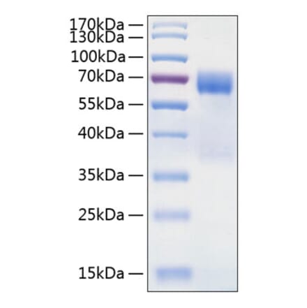 SDS-PAGE - Recombinant Human TIM 3 Protein (C-terminal Human Fc and His Tag) (A331332) - Antibodies.com
