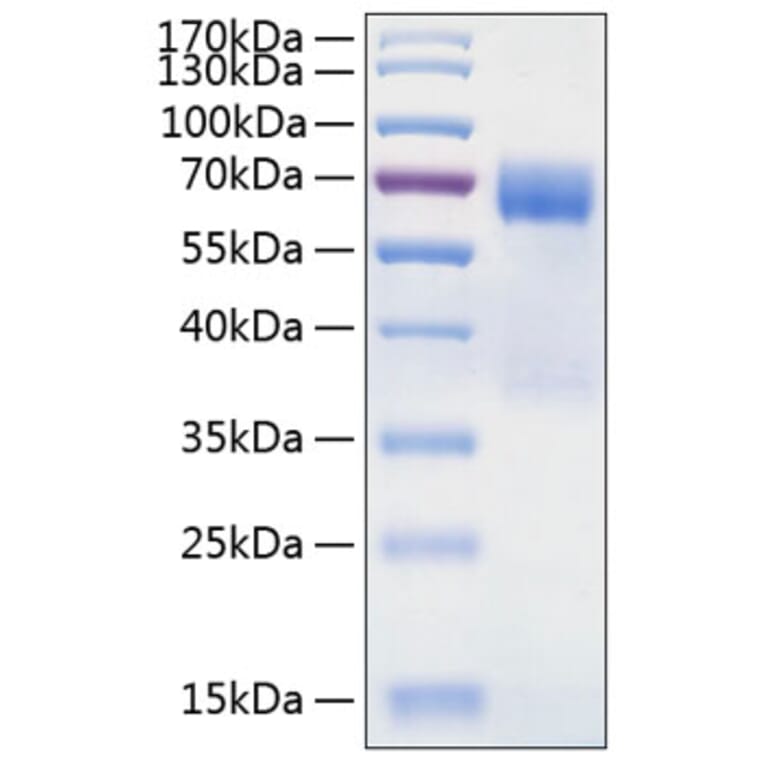 SDS-PAGE - Recombinant Human TIM 3 Protein (C-terminal Human Fc and His Tag) (A331332) - Antibodies.com