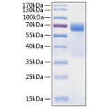 SDS-PAGE - Recombinant Human TIM 3 Protein (C-terminal Human Fc and His Tag) (A331332) - Antibodies.com