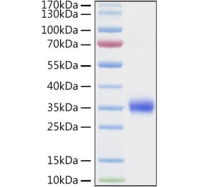 SDS-PAGE - Recombinant Human TIMP1 Protein (C-terminal His Tag) (A331333) - Antibodies.com