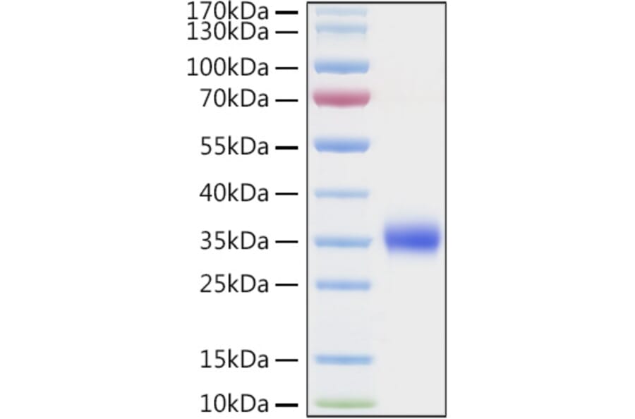 SDS-PAGE - Recombinant Human TIMP1 Protein (C-terminal His Tag) (A331333) - Antibodies.com