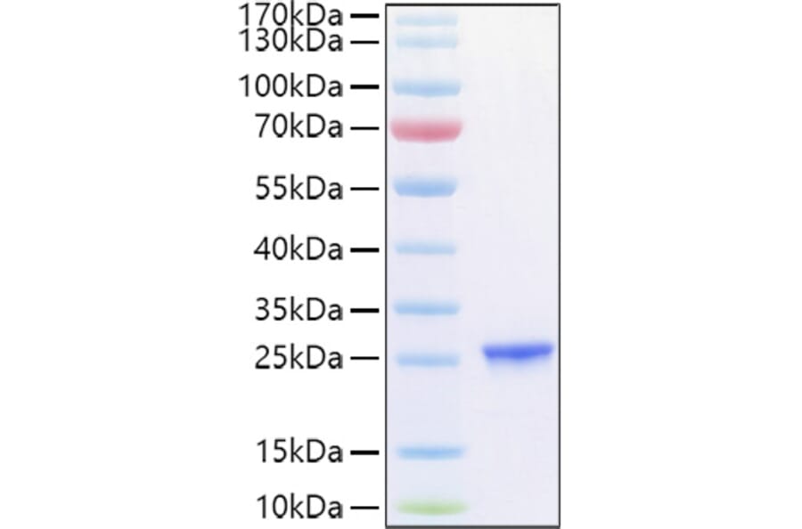 SDS-PAGE - Recombinant Human TIMP2 Protein (C-terminal His Tag) (A331334) - Antibodies.com