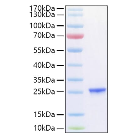 SDS-PAGE - Recombinant Human TIMP2 Protein (C-terminal His Tag) (A331334) - Antibodies.com