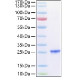 SDS-PAGE - Recombinant Human TIMP2 Protein (C-terminal His Tag) (A331334) - Antibodies.com