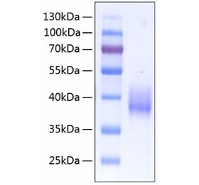 SDS-PAGE - Recombinant Human Tissue Factor Protein (C-terminal His Tag) (A331335) - Antibodies.com