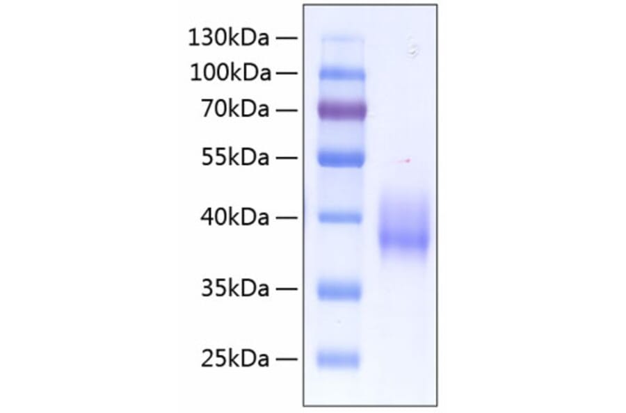 SDS-PAGE - Recombinant Human Tissue Factor Protein (C-terminal His Tag) (A331335) - Antibodies.com
