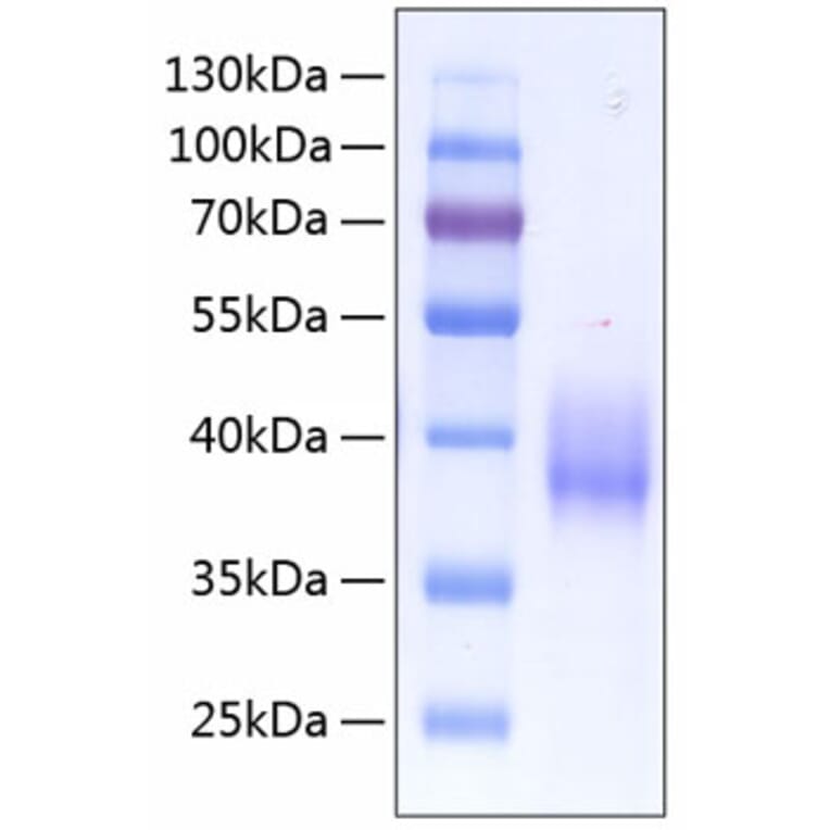 SDS-PAGE - Recombinant Human Tissue Factor Protein (C-terminal His Tag) (A331335) - Antibodies.com