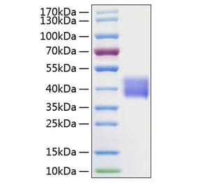 SDS-PAGE - Recombinant Human Tissue kallikrein Protein (C-terminal His Tag) (A331336) - Antibodies.com