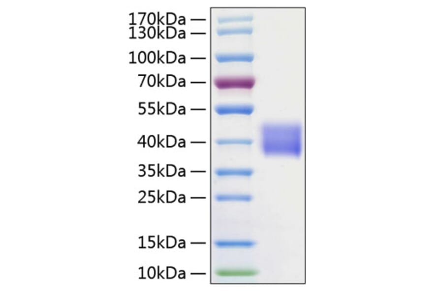 SDS-PAGE - Recombinant Human Tissue kallikrein Protein (C-terminal His Tag) (A331336) - Antibodies.com
