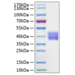 SDS-PAGE - Recombinant Human Tissue kallikrein Protein (C-terminal His Tag) (A331336) - Antibodies.com