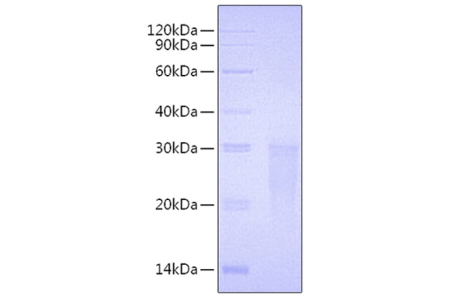 SDS-PAGE - Recombinant Human TMIGD2 Protein (C-terminal His Tag) (A331338) - Antibodies.com