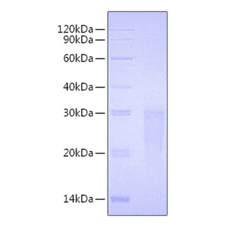 SDS-PAGE - Recombinant Human TMIGD2 Protein (C-terminal His Tag) (A331338) - Antibodies.com