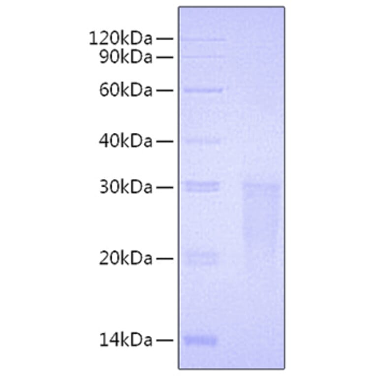 SDS-PAGE - Recombinant Human TMIGD2 Protein (C-terminal His Tag) (A331338) - Antibodies.com