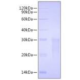 SDS-PAGE - Recombinant Human TMIGD2 Protein (C-terminal His Tag) (A331338) - Antibodies.com