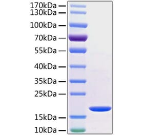 SDS-PAGE - Recombinant Human TNF alpha Protein (C-terminal His Tag) (A331339) - Antibodies.com