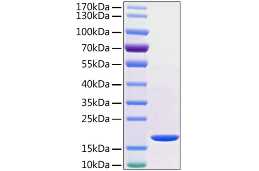 SDS-PAGE - Recombinant Human TNF alpha Protein (C-terminal His Tag) (A331339) - Antibodies.com