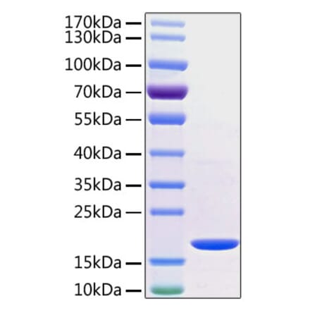 SDS-PAGE - Recombinant Human TNF alpha Protein (C-terminal His Tag) (A331339) - Antibodies.com