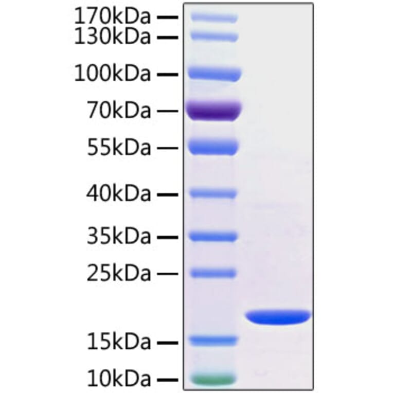 SDS-PAGE - Recombinant Human TNF alpha Protein (C-terminal His Tag) (A331339) - Antibodies.com