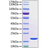 SDS-PAGE - Recombinant Human TNF alpha Protein (C-terminal His Tag) (A331339) - Antibodies.com