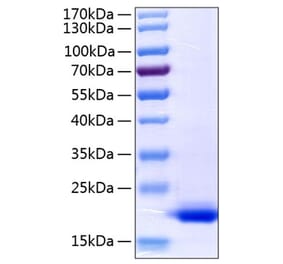 SDS-PAGE - Recombinant Human TNF alpha Protein (C-terminal His Tag) (A331340) - Antibodies.com