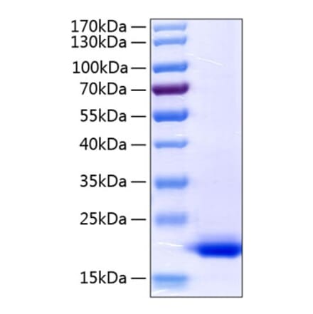 SDS-PAGE - Recombinant Human TNF alpha Protein (C-terminal His Tag) (A331340) - Antibodies.com
