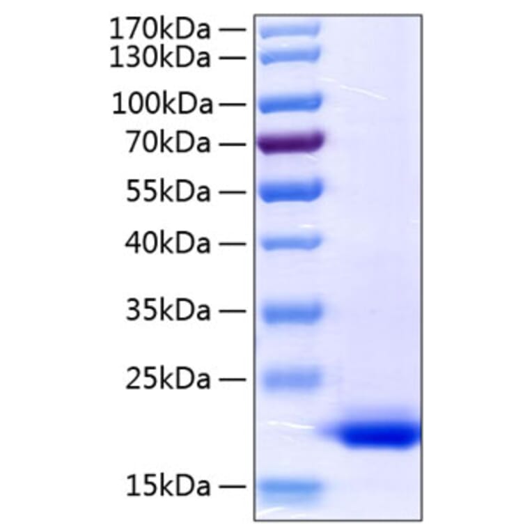 SDS-PAGE - Recombinant Human TNF alpha Protein (C-terminal His Tag) (A331340) - Antibodies.com