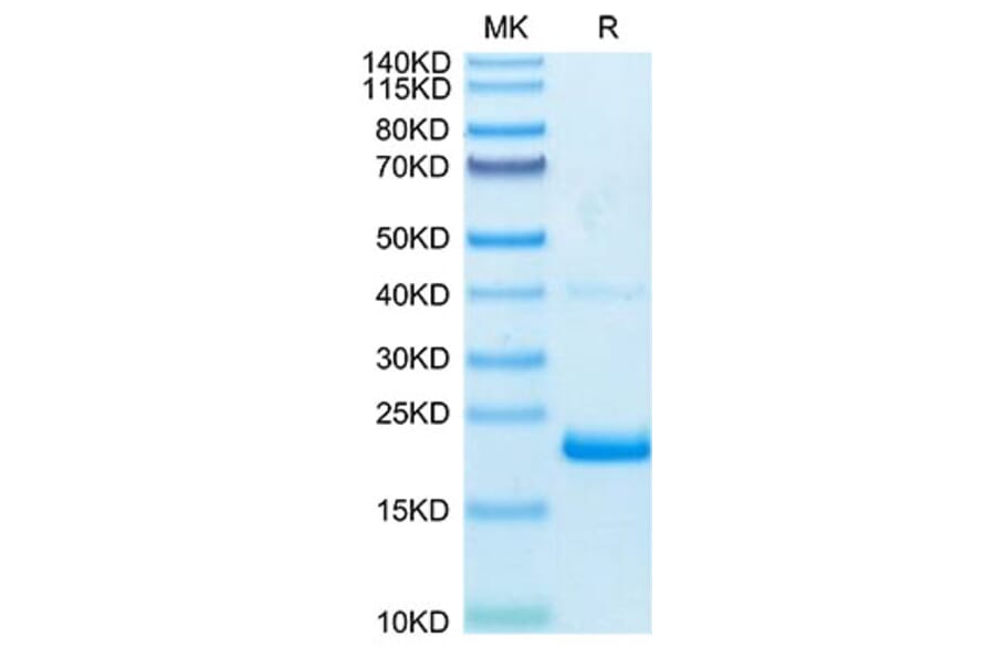 Tris-Bis PAGE - Recombinant Human TNF alpha Protein (Biotin) (C-terminal His and Avi Tag) (A331341) - Antibodies.com