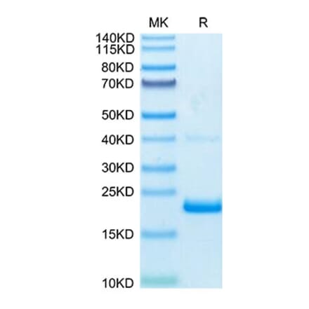 Tris-Bis PAGE - Recombinant Human TNF alpha Protein (Biotin) (C-terminal His and Avi Tag) (A331341) - Antibodies.com