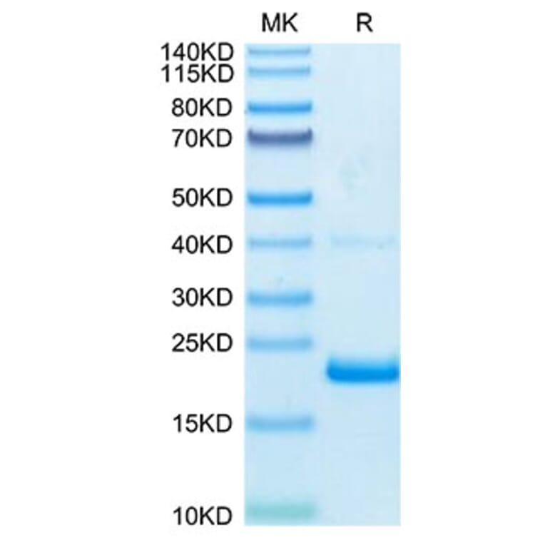 Tris-Bis PAGE - Recombinant Human TNF alpha Protein (Biotin) (C-terminal His and Avi Tag) (A331341) - Antibodies.com