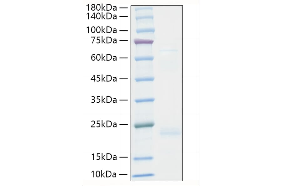 SDS-PAGE - Recombinant Human TNF beta Protein (A331342) - Antibodies.com