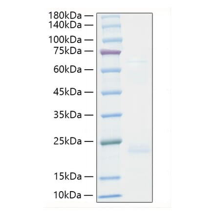 SDS-PAGE - Recombinant Human TNF beta Protein (A331342) - Antibodies.com