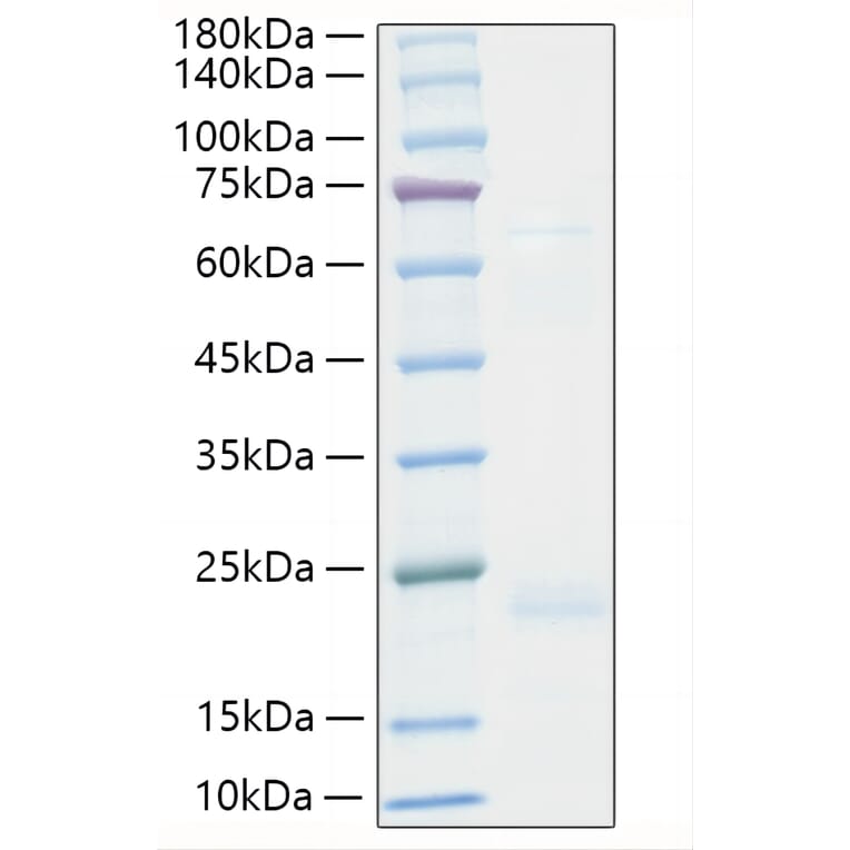 SDS-PAGE - Recombinant Human TNF beta Protein (A331342) - Antibodies.com