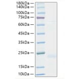 SDS-PAGE - Recombinant Human TNF beta Protein (A331342) - Antibodies.com