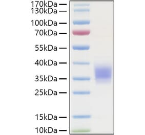 SDS-PAGE - Recombinant Human TNFR1 Protein (C-terminal His Tag) (A331343) - Antibodies.com