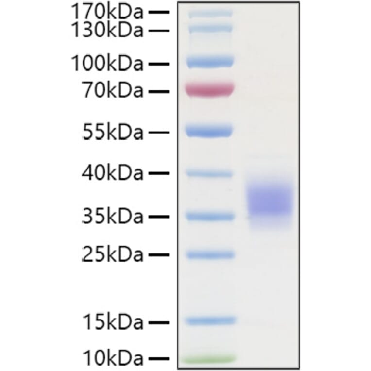 SDS-PAGE - Recombinant Human TNFR1 Protein (C-terminal His Tag) (A331343) - Antibodies.com