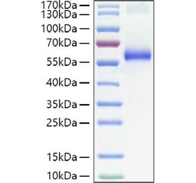 SDS-PAGE - Recombinant Human TNFR1 Protein (C-terminal Human Fc Tag) (A331344) - Antibodies.com