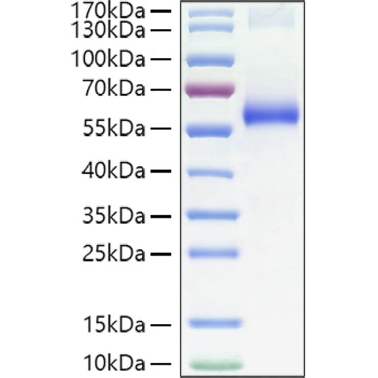 SDS-PAGE - Recombinant Human TNFR1 Protein (C-terminal Human Fc Tag) (A331344) - Antibodies.com
