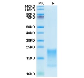 Tris-Bis PAGE - Recombinant Cynomolgus macaque TNFRSF13C Protein (C-terminal His Tag) (A331345) - Antibodies.com