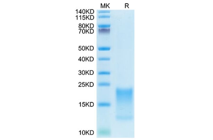 Tris-Bis PAGE - Recombinant Cynomolgus macaque TNFRSF13C Protein (C-terminal His Tag) (A331345) - Antibodies.com