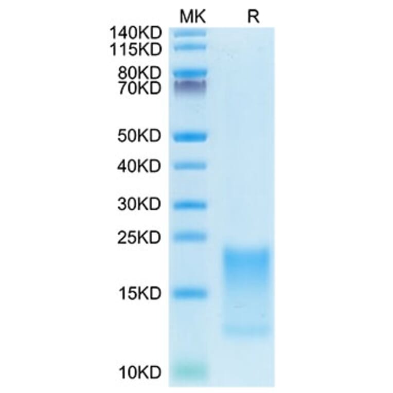 Tris-Bis PAGE - Recombinant Cynomolgus macaque TNFRSF13C Protein (C-terminal His Tag) (A331345) - Antibodies.com