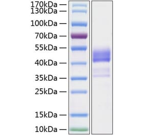 SDS-PAGE - Recombinant Human TNFRSF13C Protein (C-terminal Human Fc and His Tag) (A331346) - Antibodies.com