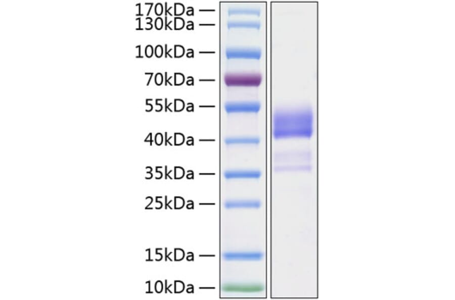 SDS-PAGE - Recombinant Human TNFRSF13C Protein (C-terminal Human Fc and His Tag) (A331346) - Antibodies.com