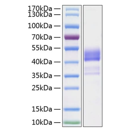 SDS-PAGE - Recombinant Human TNFRSF13C Protein (C-terminal Human Fc and His Tag) (A331346) - Antibodies.com