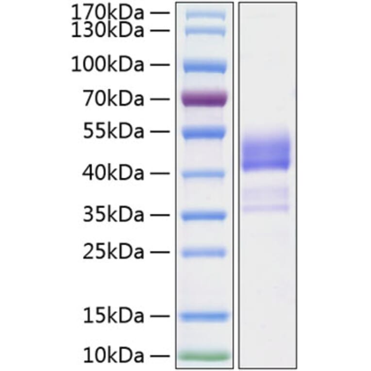 SDS-PAGE - Recombinant Human TNFRSF13C Protein (C-terminal Human Fc and His Tag) (A331346) - Antibodies.com